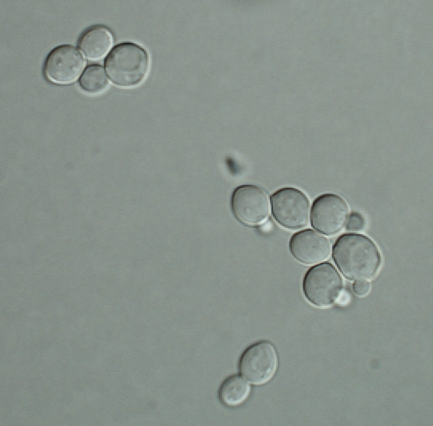 Saccharomyces 酵母菌